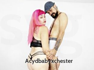 Acydbabyxchester
