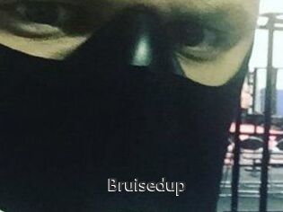 Bruisedup